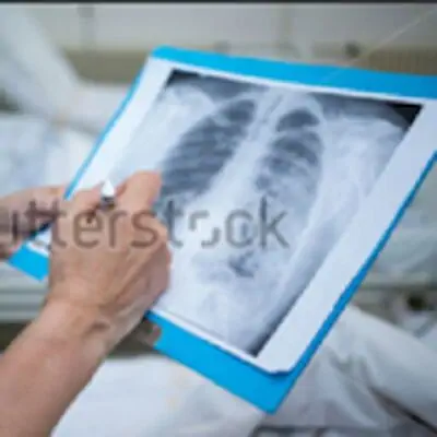 Chest X-Ray Based Cases