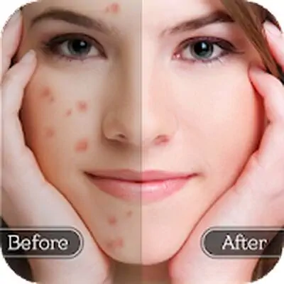 Download Face Blemish Remover MOD APK [Pro Version] for Android ver. 1.7