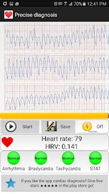Download Hack Cardiac diagnosis (arrhythmia) [Premium MOD] for Android ver. 146