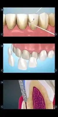 Download Hack Dental 3D Illustrations for patient education [Premium MOD] for Android ver. 2.0.71