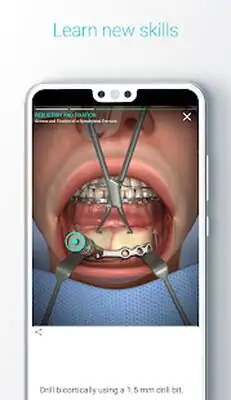 Download Hack Touch Surgery: Surgical Videos MOD APK? ver. 6.36.0