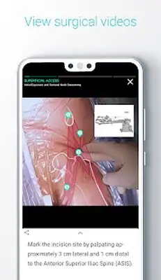 Download Hack Touch Surgery: Surgical Videos MOD APK? ver. 6.36.0