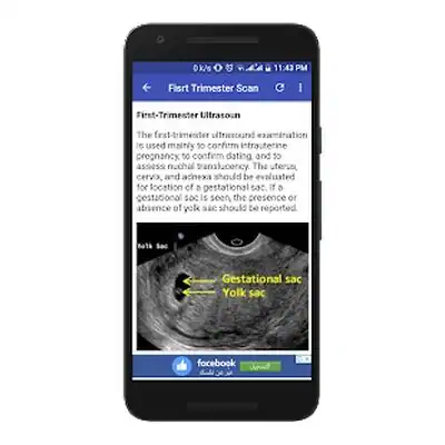 Download Hack Obstetrics & Gyenacology Ultrasound Guide MOD APK? ver. 1.2.1.AZ